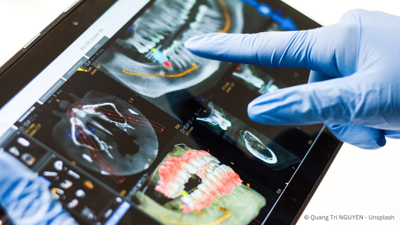 3D-Röntgenaufnahmen der Zähne und Kiefer für sichere Implantation